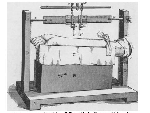 Aesthesiometer